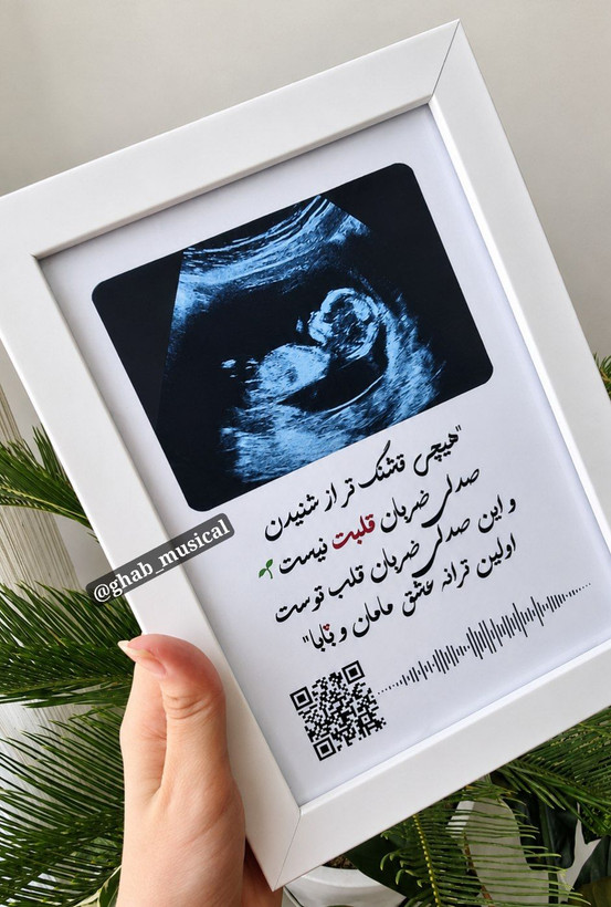 قاب موزیکال قاب سنوگرافی آوای ماندگار